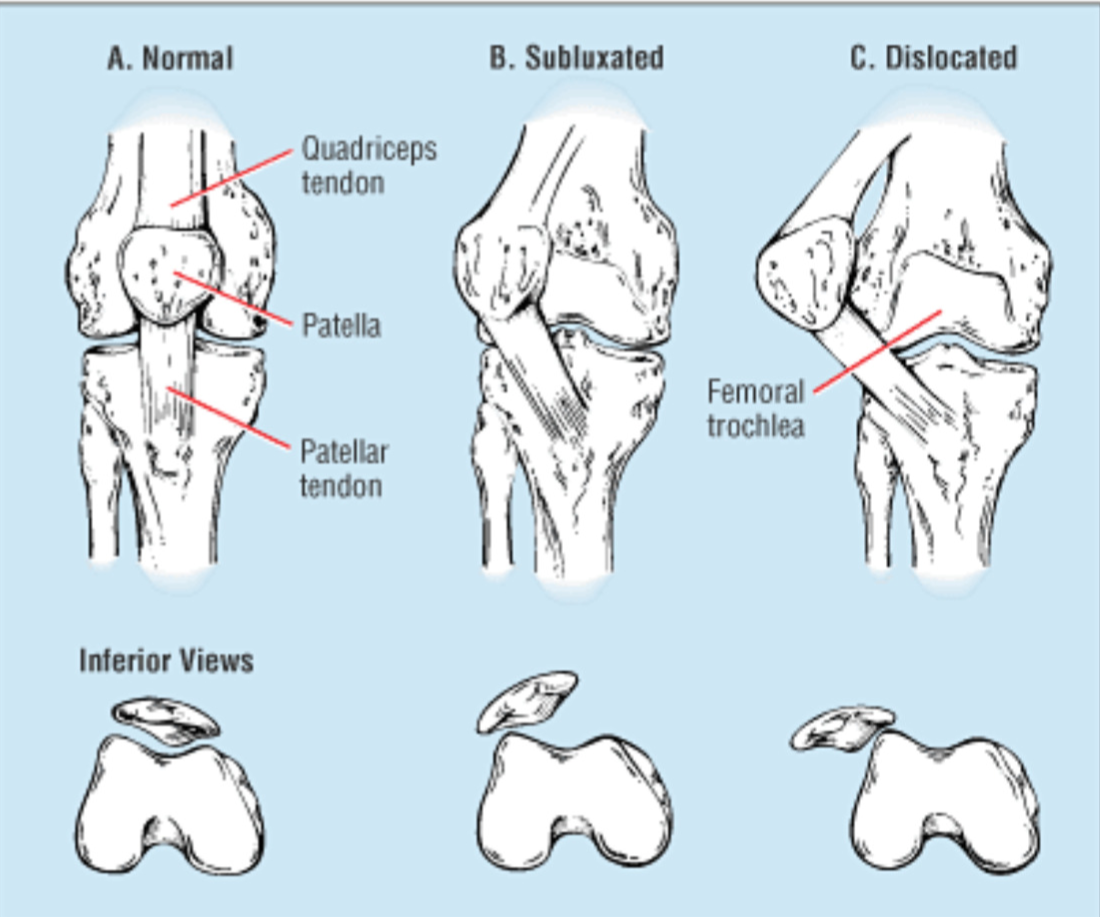 Patella diagram