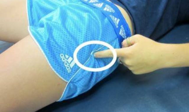 Lateral Hip Pain (Outer)