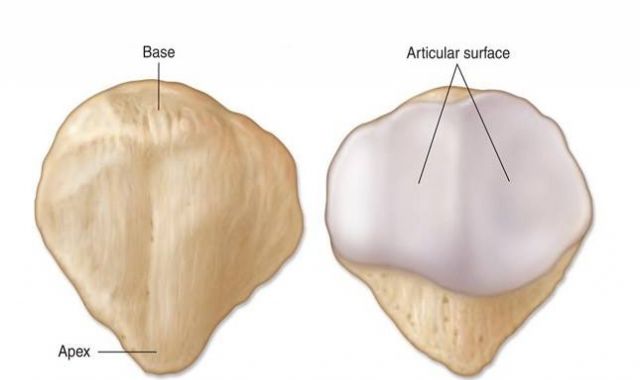 Who is more likely to have anterior patella pain (knee cap)?