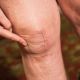 Go to What Can Go Wrong with Knee Replacement????