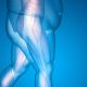 Go to Obesity and Joint Replacement Surgery