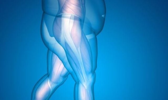 Obesity and Joint Replacement Surgery